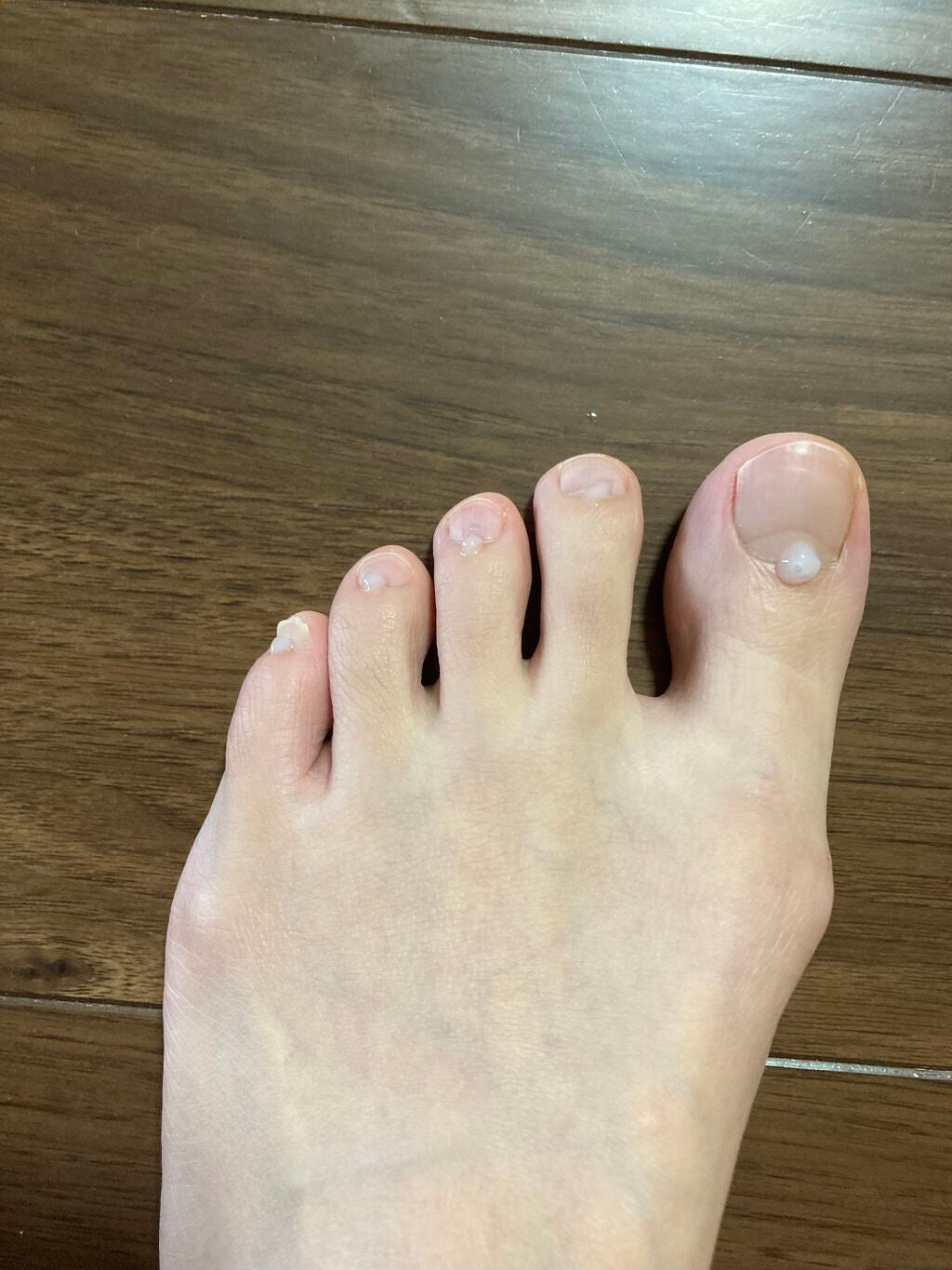 薬用 クリアストロングショット アルファ/北の快適工房/レッグ・フットケアを使ったクチコミ(3枚目)