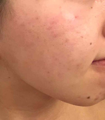 を使ったクチコミ(2枚目)