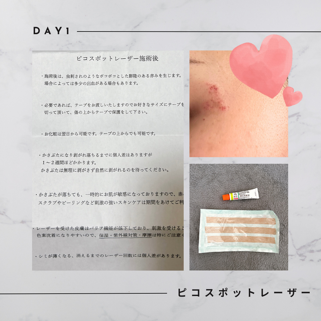 を使ったクチコミ（1枚目）