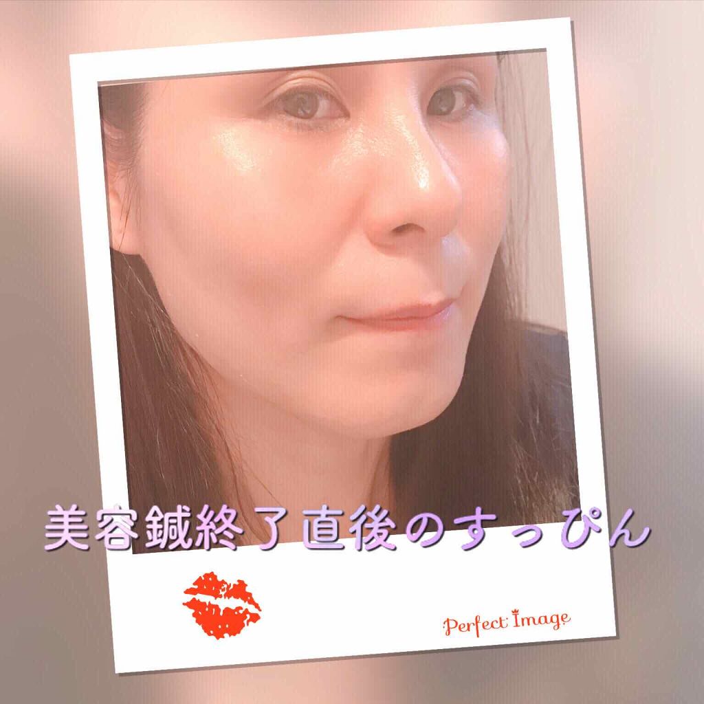 ホリスティック キュア カールアイロン/ホリスティックキュア/カールアイロンを使ったクチコミ(2枚目)