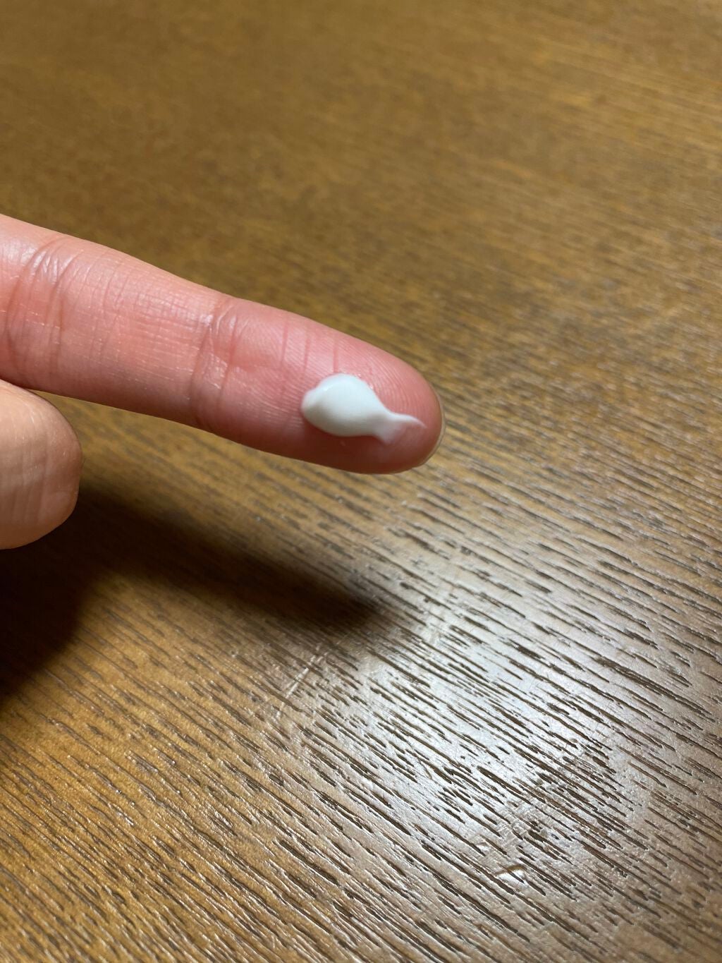 ザーネメディカルクリーム(医薬品)/ザーネ/その他を使ったクチコミ(1枚目)