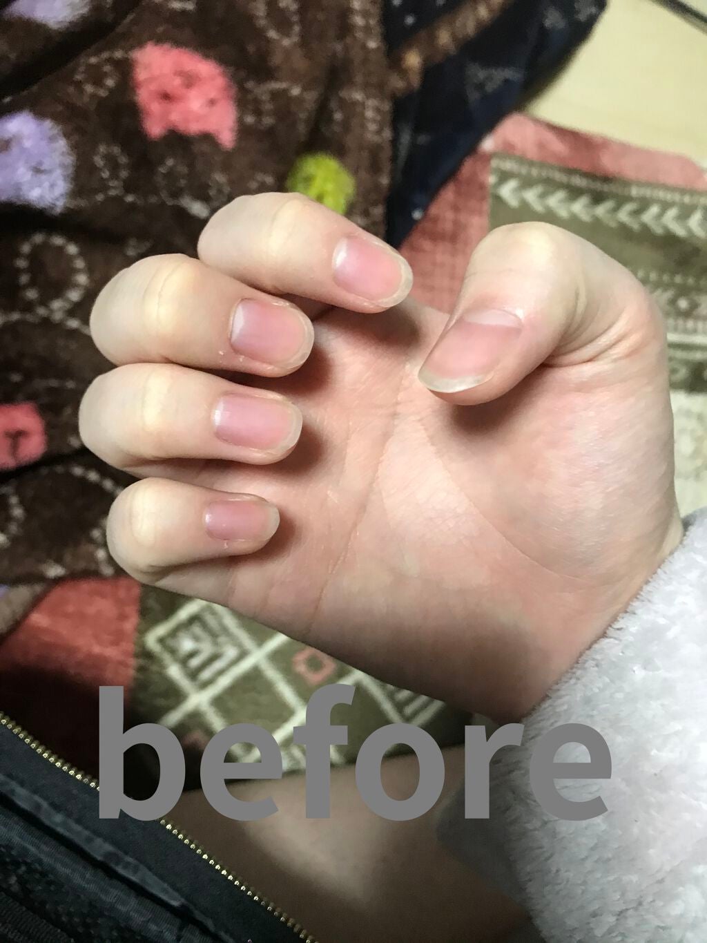 アロマキューティクルオイル/D-UP/ネイルオイル・トリートメントを使ったクチコミ(2枚目)