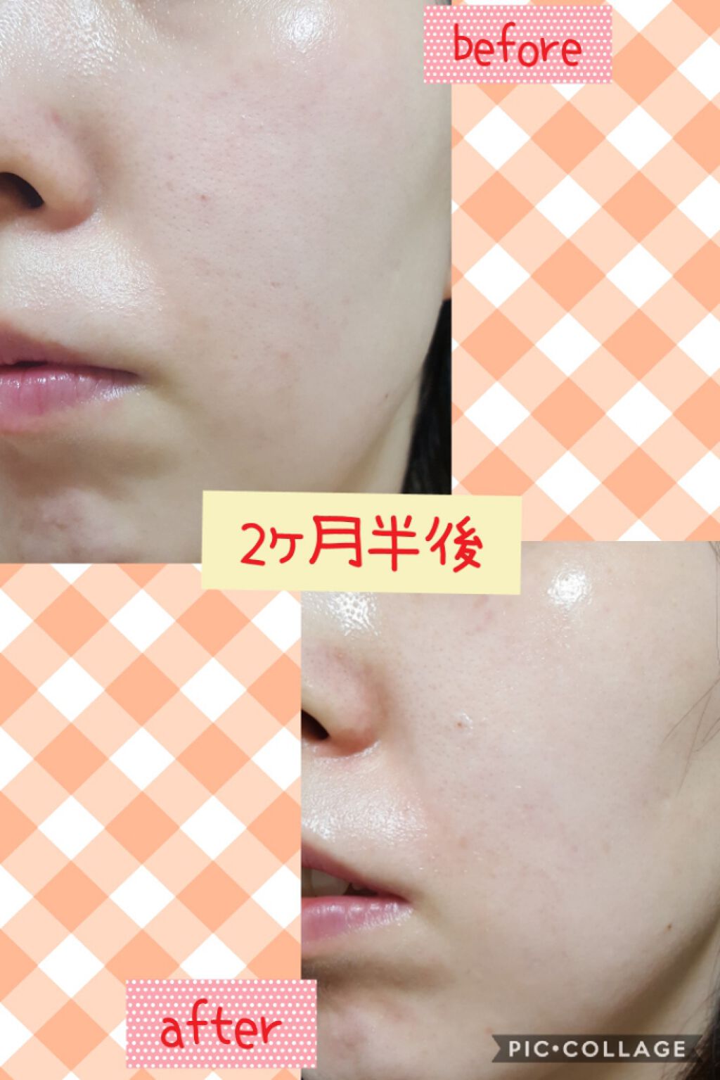 オバジC25セラムNEO/オバジ/美容液を使ったクチコミ（3枚目）