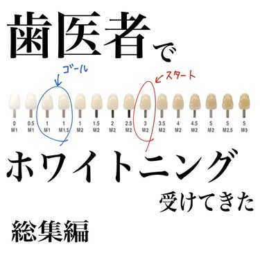 さくまと申します☻

ついにオフィスホワイトニングが完了しましたので総集編です✨

結論は"日本人の標準色"から
自信を持って笑えるレベルの白さになりました！

part.1とpart.2も投稿しており