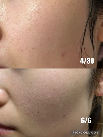 5番 白玉グルタチオンC美容液/numbuzin/美容液を使ったクチコミ(5枚目)