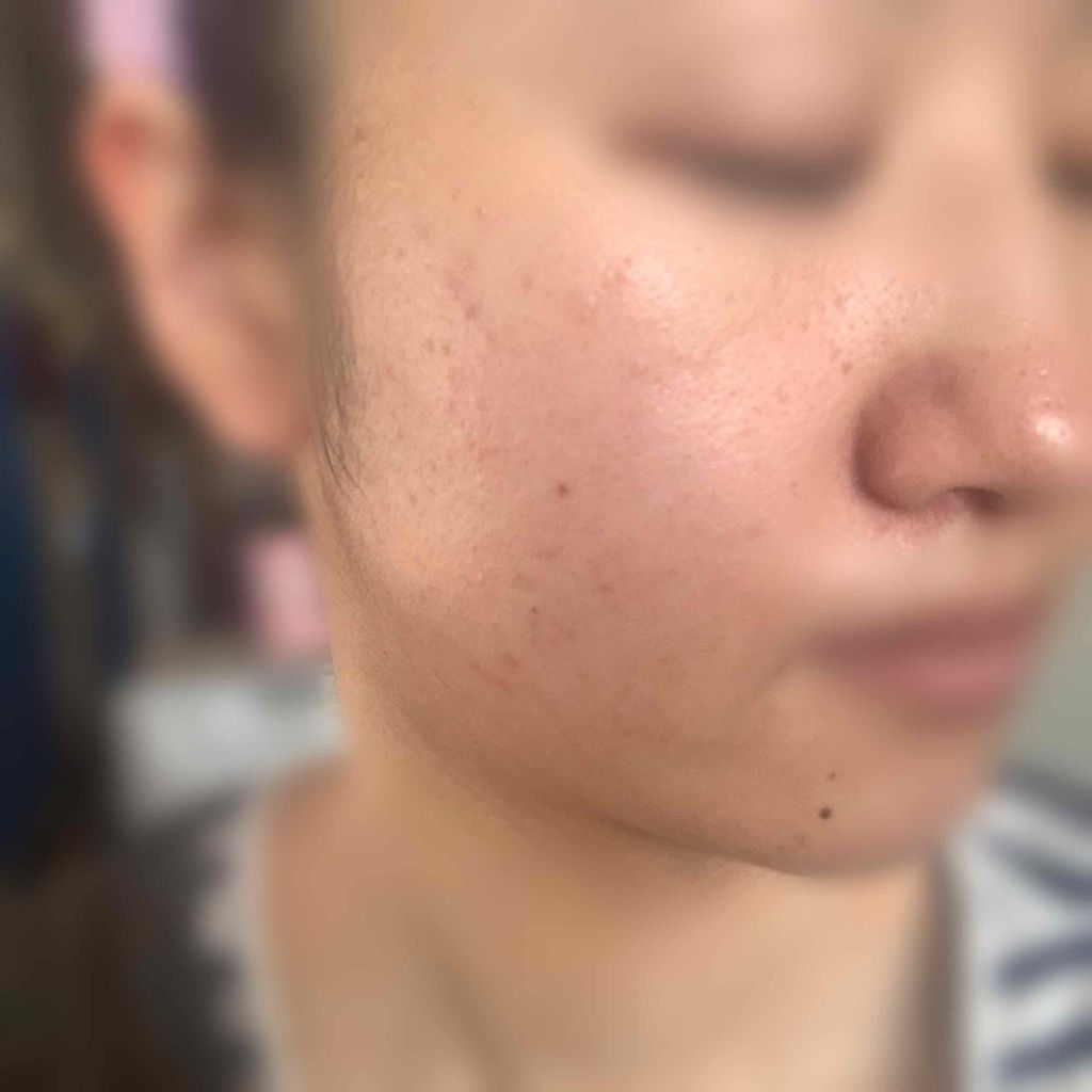 ハトムギ化粧水(ナチュリエ スキンコンディショナー R )/ナチュリエ/化粧水を使ったクチコミ(3枚目)