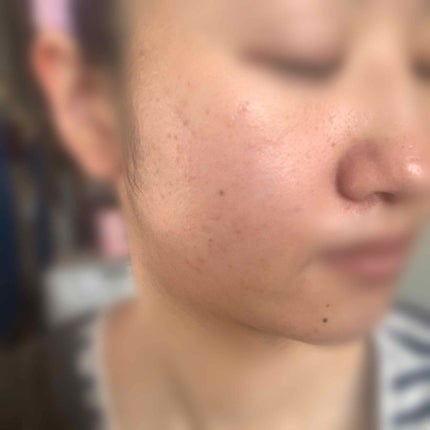 ハトムギ化粧水(ナチュリエ スキンコンディショナー R )/ナチュリエ/化粧水を使ったクチコミ(3枚目)