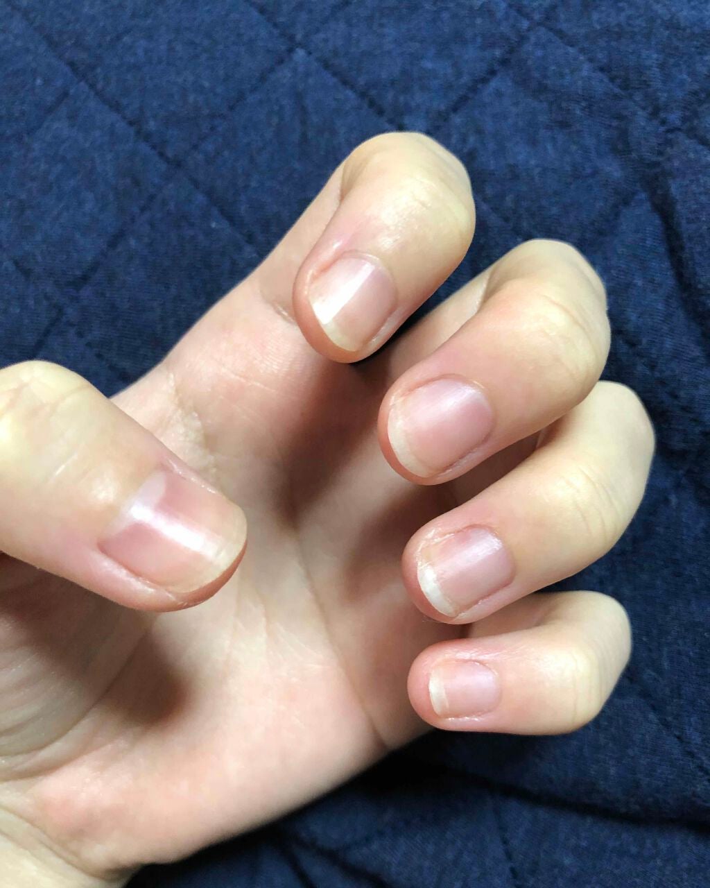 キューティクルオイルⅡ/デュカート/ネイルオイル・トリートメントを使ったクチコミ(1枚目)