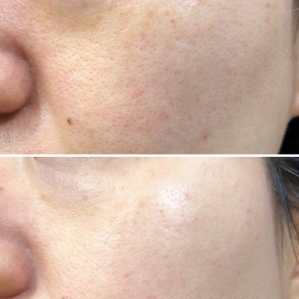 ピンクレシピ グロウアップジェル/ピンクレシピ/オールインワン化粧品を使ったクチコミ(4枚目)