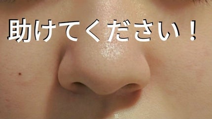 大福 on LIPS 「肌荒れからの脱却!美肌になりたい人間の記録です(これでも一時期..」(1枚目)