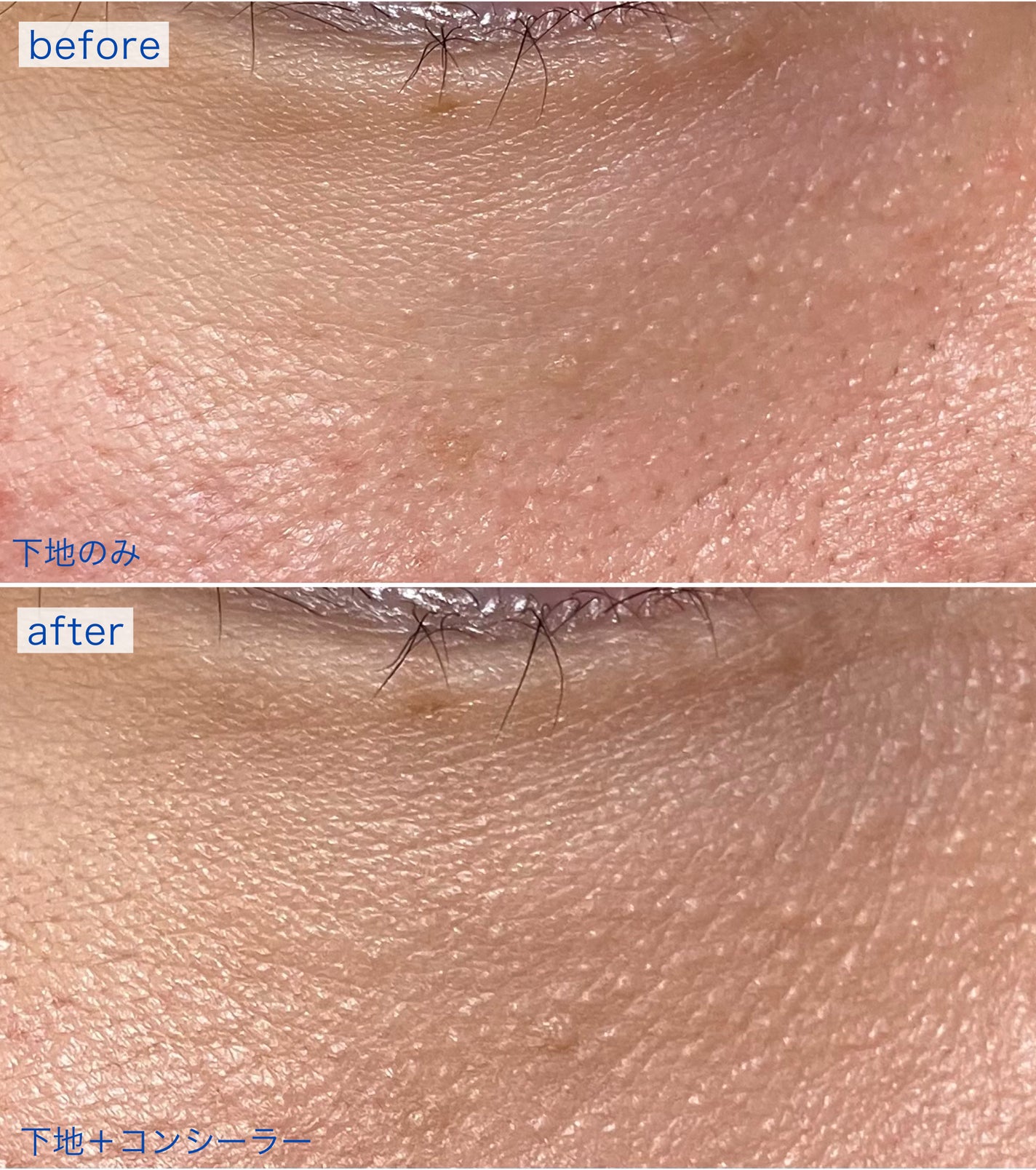 コレクチュールエクラプールレジュー/クレ・ド・ポー ボーテ/リキッドコンシーラーを使ったクチコミ(3枚目)