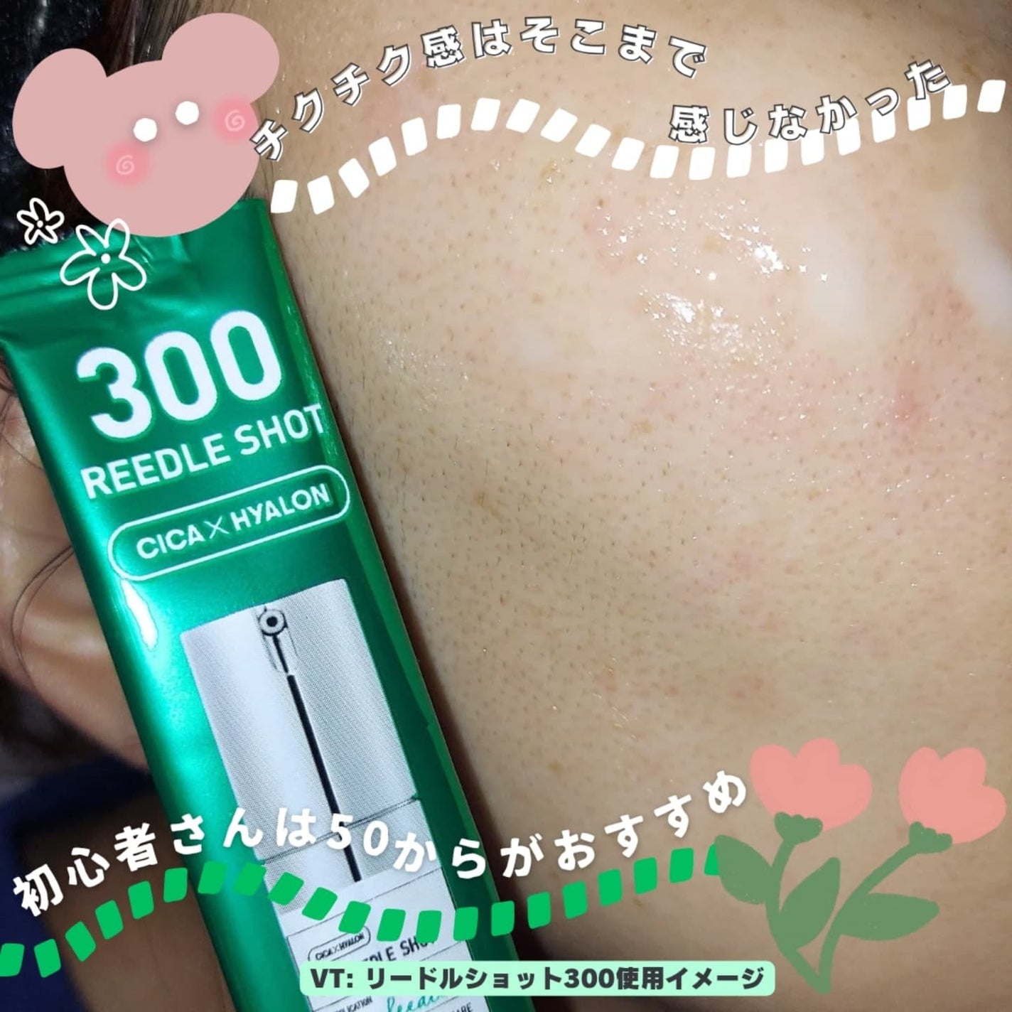 ピーディーアールエヌエッセンス PDRN 100/VT/美容液を使ったクチコミ(4枚目)