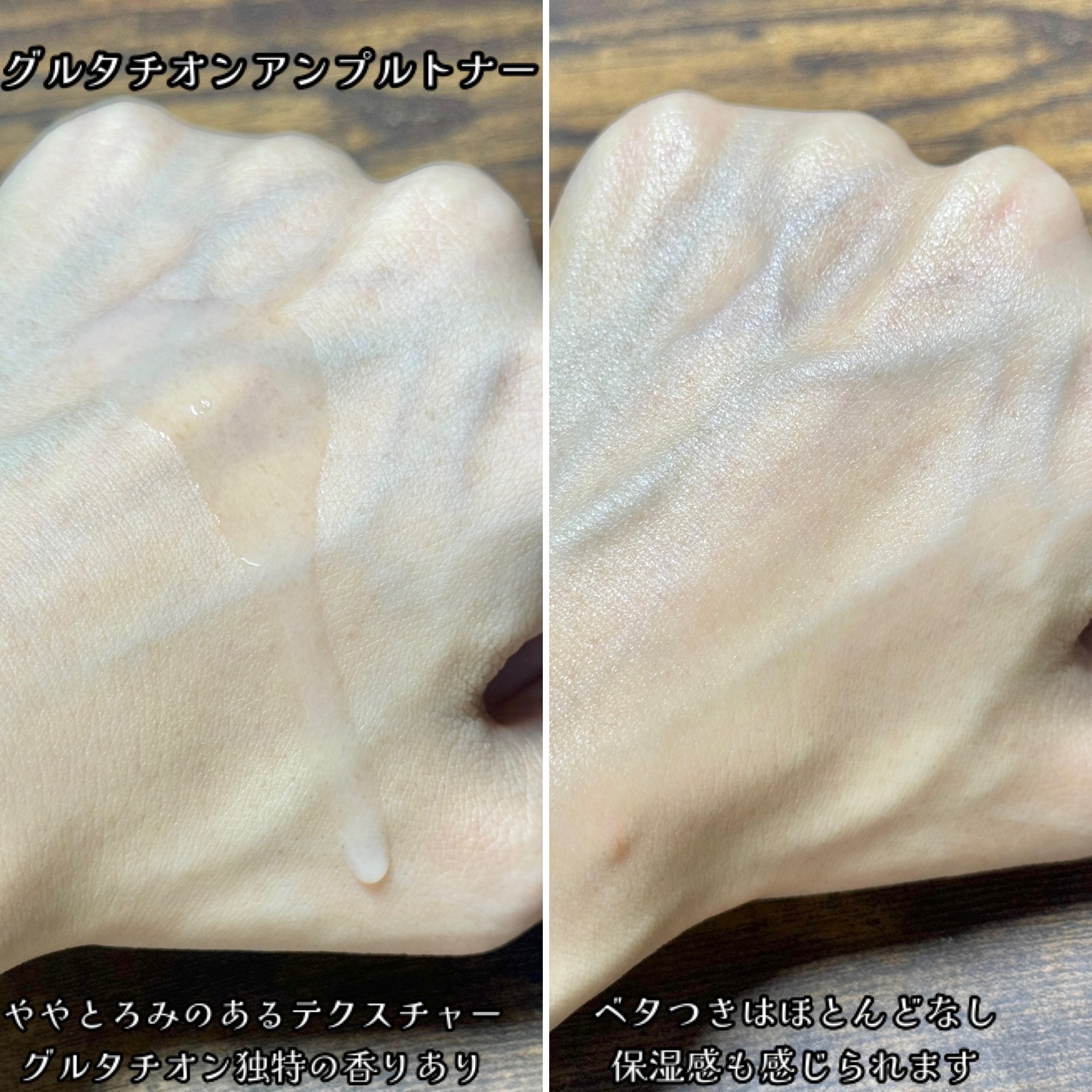 ヴィーガンリポソームレチノールセラム/SKIN&LAB/美容液を使ったクチコミ（2枚目）