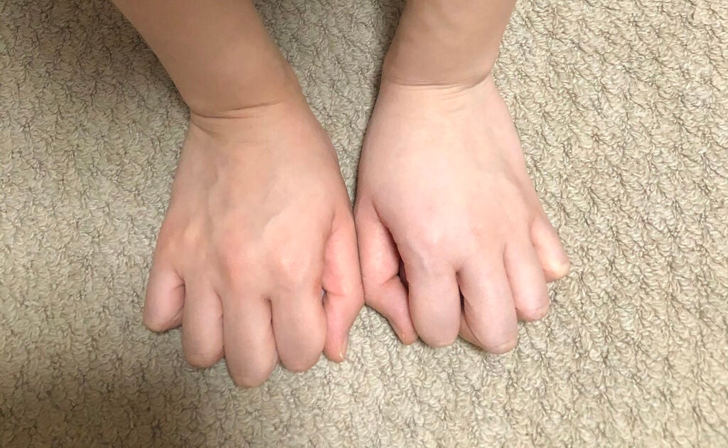 薬用ホワイトコンク ホワイトニングCC CII/ホワイトコンク/ボディクリームを使ったクチコミ(4枚目)