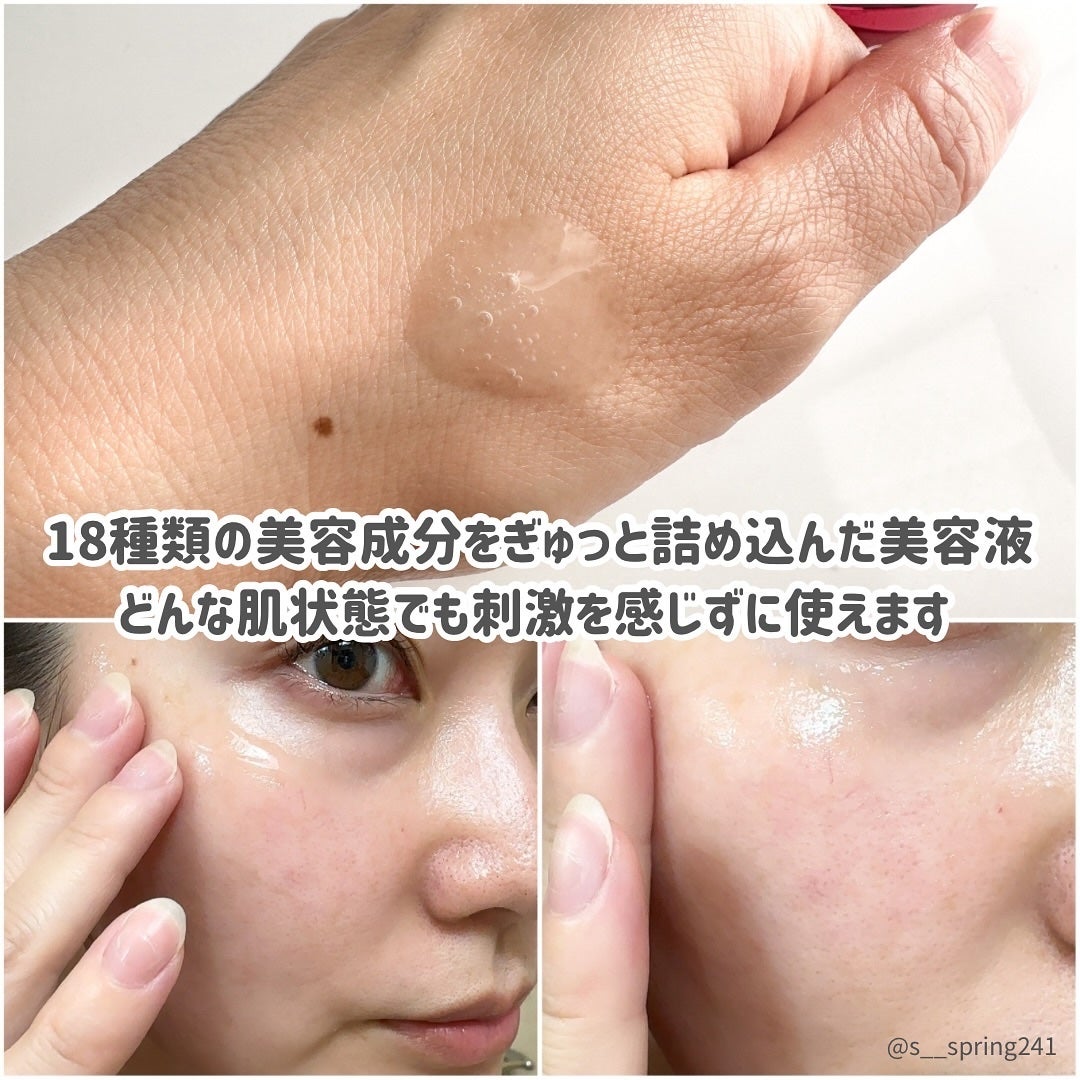 アルティミューン パワライジング コンセントレート Ⅲn/SHISEIDO/美容液を使ったクチコミ(3枚目)