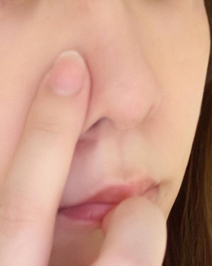 リサラット/ニカプラス/フェイスクリームを使ったクチコミ(5枚目)