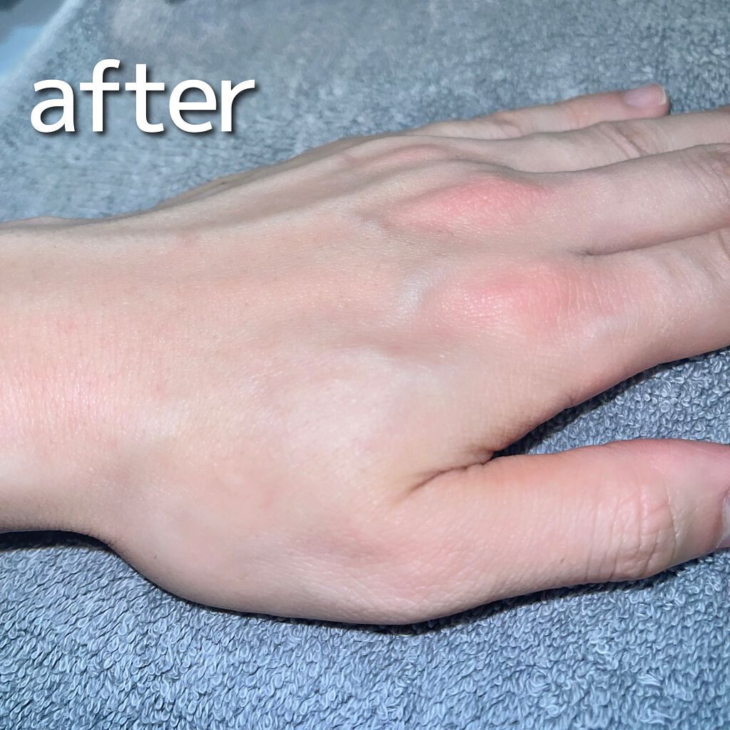 NONON/NONON(ノンノン)/除毛クリームを使ったクチコミ(5枚目)