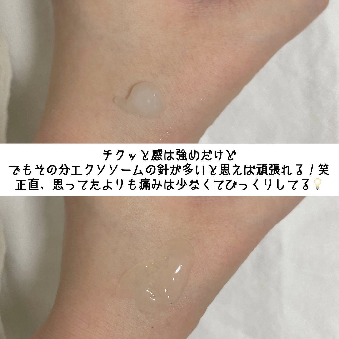 ゼロ1DAYエクソソームショット2000/MEDICUBE/美容液を使ったクチコミ(6枚目)