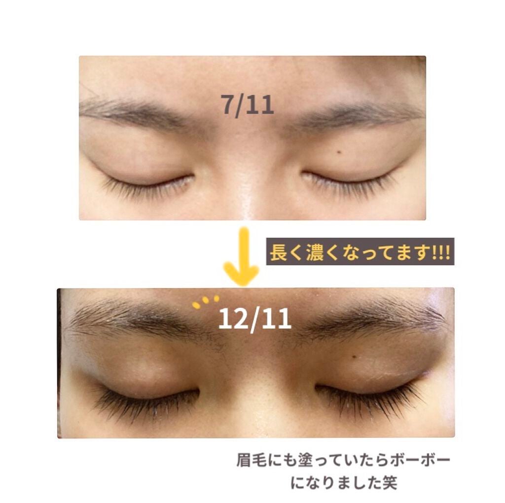 スカルプD ボーテ ピュアフリーアイラッシュセラム/アンファー(スカルプD)/まつげ美容液を使ったクチコミ(3枚目)