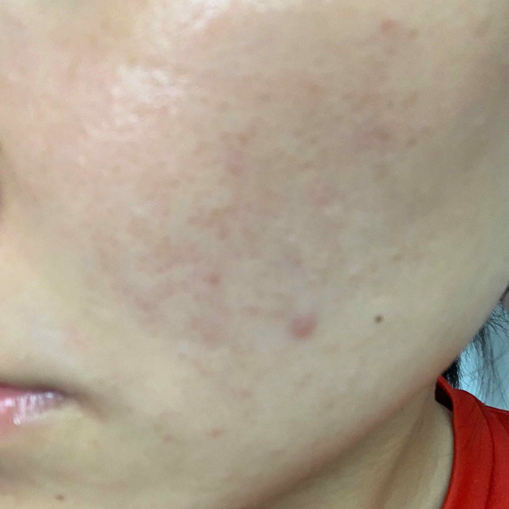 ドクタージャルト シカペア クリーム （第2世代）/Dr.Jart＋/フェイスクリームを使ったクチコミ（1枚目）