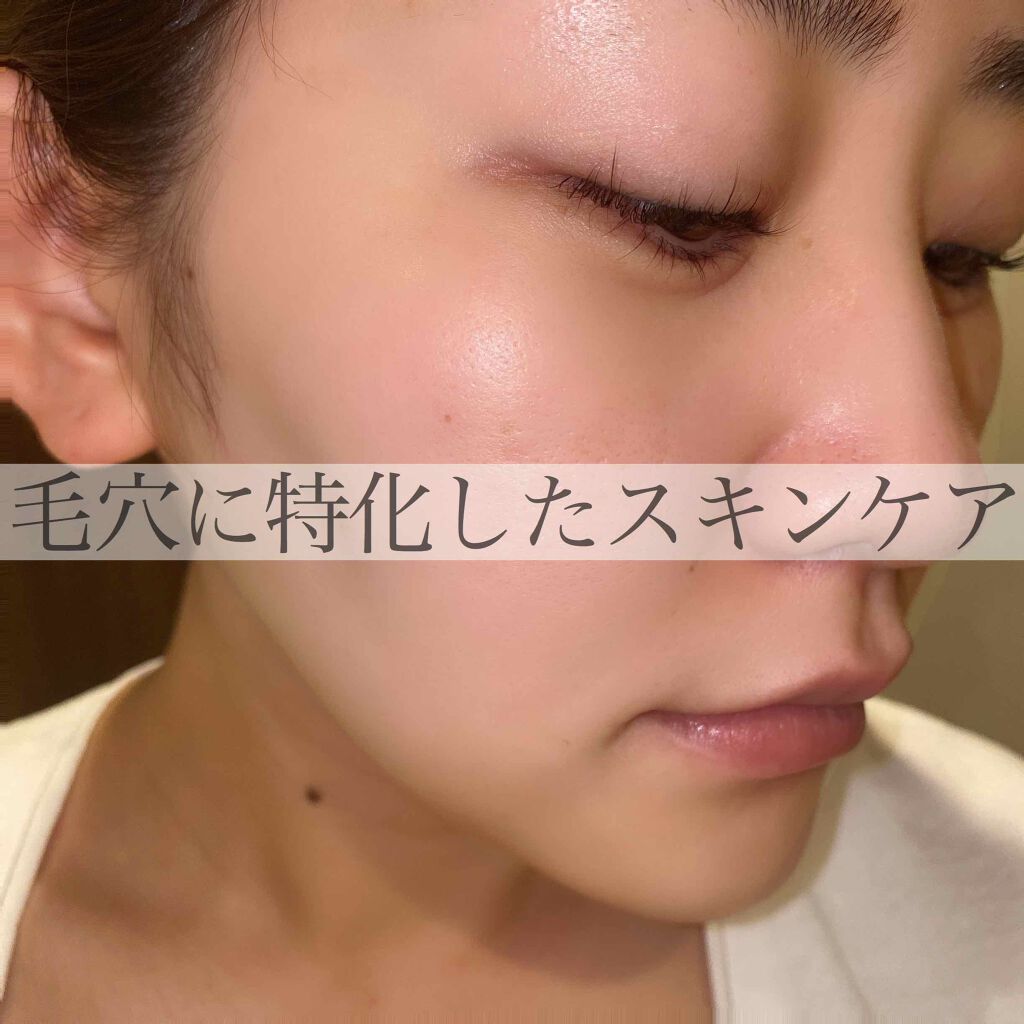 エンリッチCセラム/IGA LAB/美容液を使ったクチコミ(1枚目)