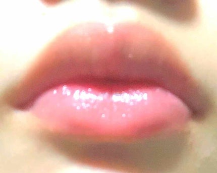 モアリップ N (医薬品)/資生堂薬品/その他を使ったクチコミ(2枚目)