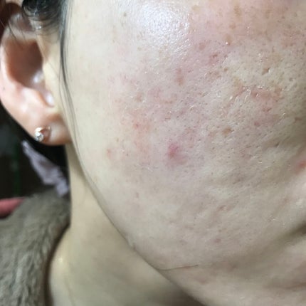 N10+Z1フェイスセラム /The Ordinary/美容液を使ったクチコミ(1枚目)