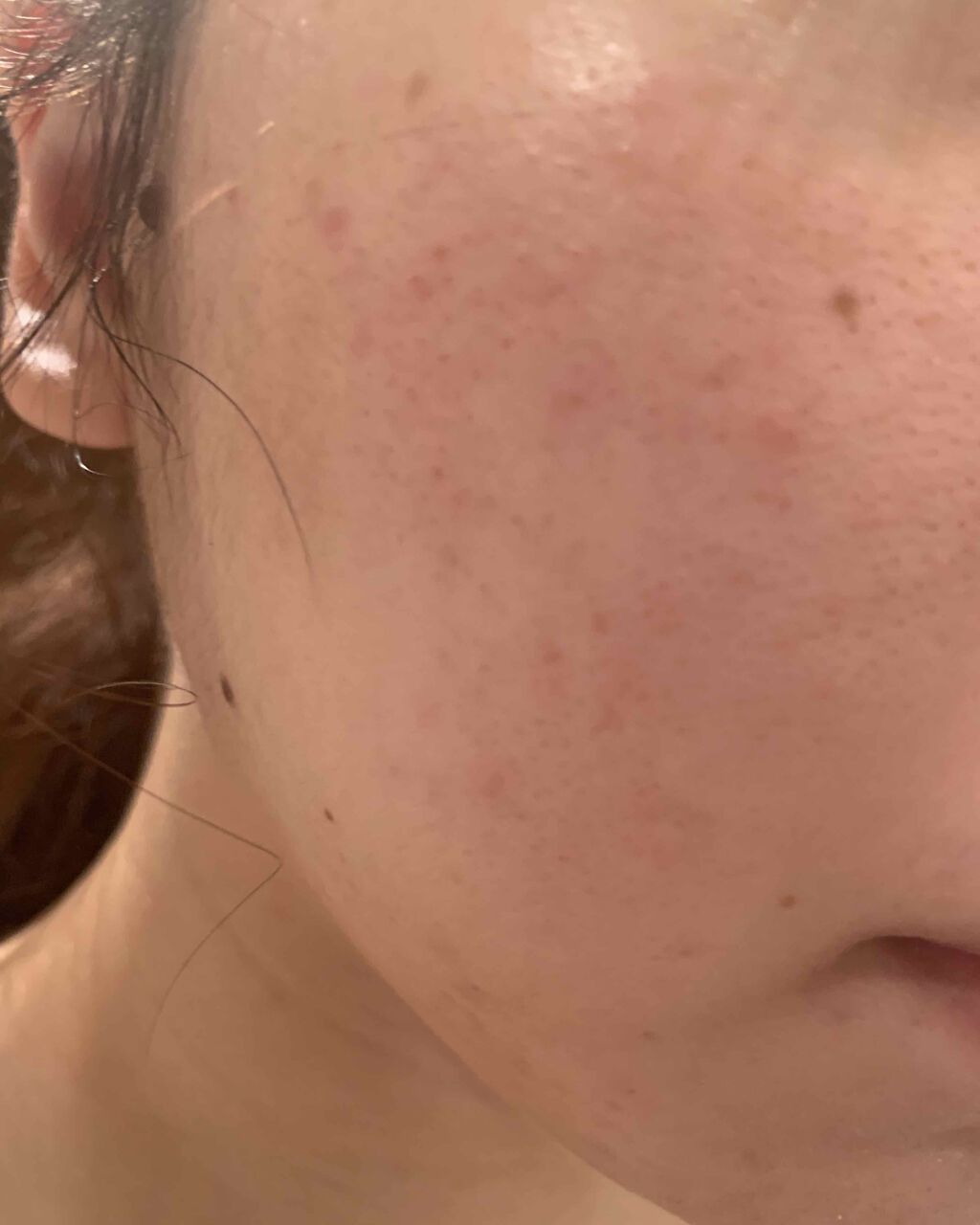 A アクネフォーム/NOV/洗顔フォームを使ったクチコミ（3枚目）