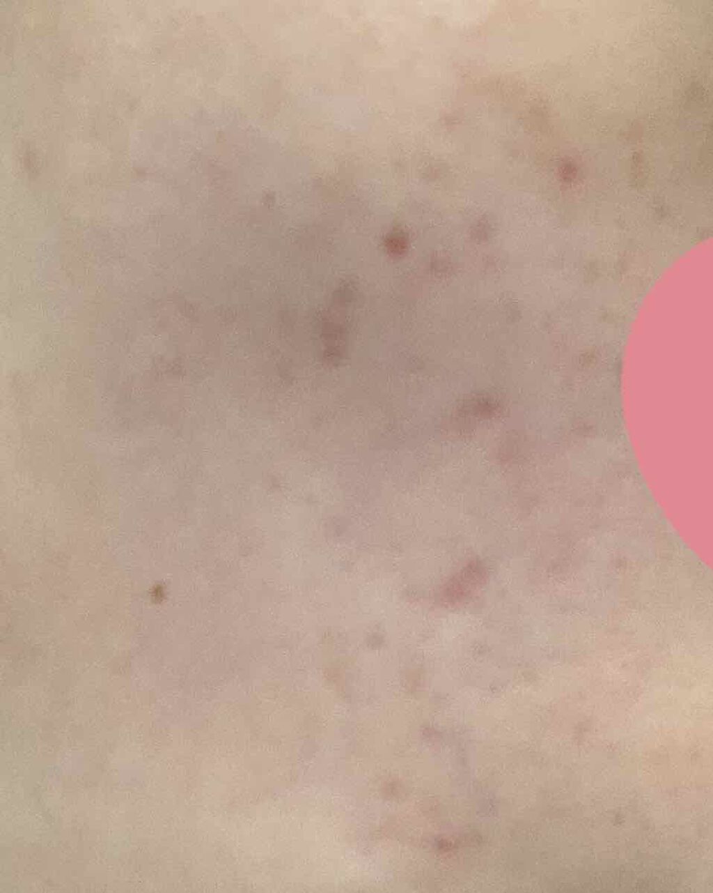 AHA·BHA·PHA 30デイズミラクルトナー/SOME BY MI/化粧水を使ったクチコミ（2枚目）