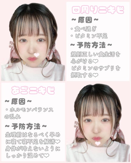 ごめんね素肌 キニナルマスク/クリアターン/シートマスク・パックを使ったクチコミ(4枚目)