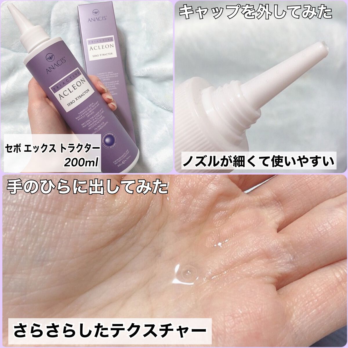 アクレオンセボエクストラクター/ANACIS/その他スキンケアを使ったクチコミ(2枚目)