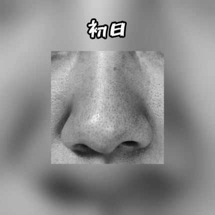 デュオ ザ クレンジングバーム ブラック/DUO/クレンジングバームを使ったクチコミ(2枚目)