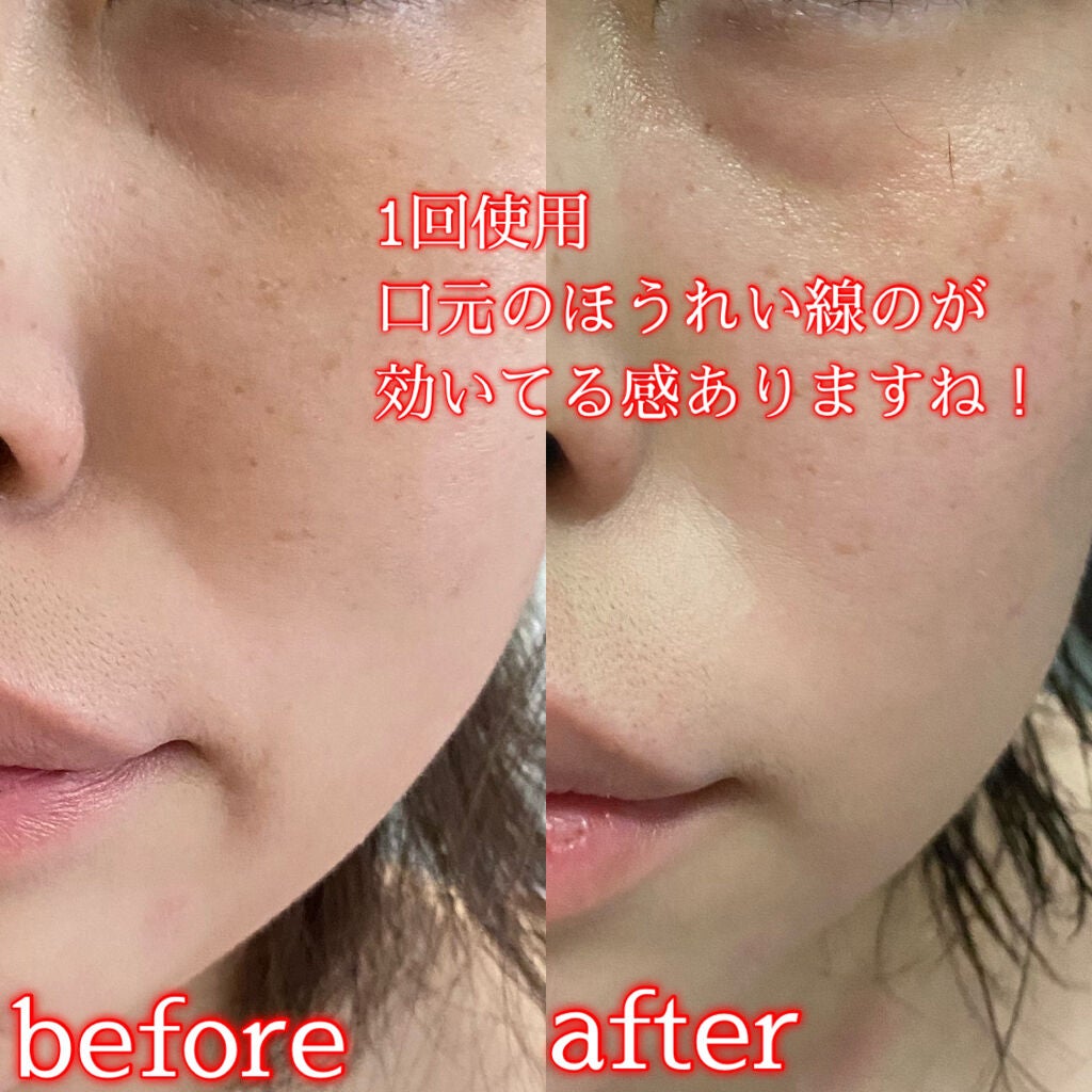 肌ふっくら アイゾーンマスク/クリアターン/シートマスク・パックを使ったクチコミ(3枚目)