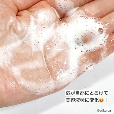 炭酸ホットクレンジング/肌ナチュール/その他洗顔料を使ったクチコミ（7枚目）