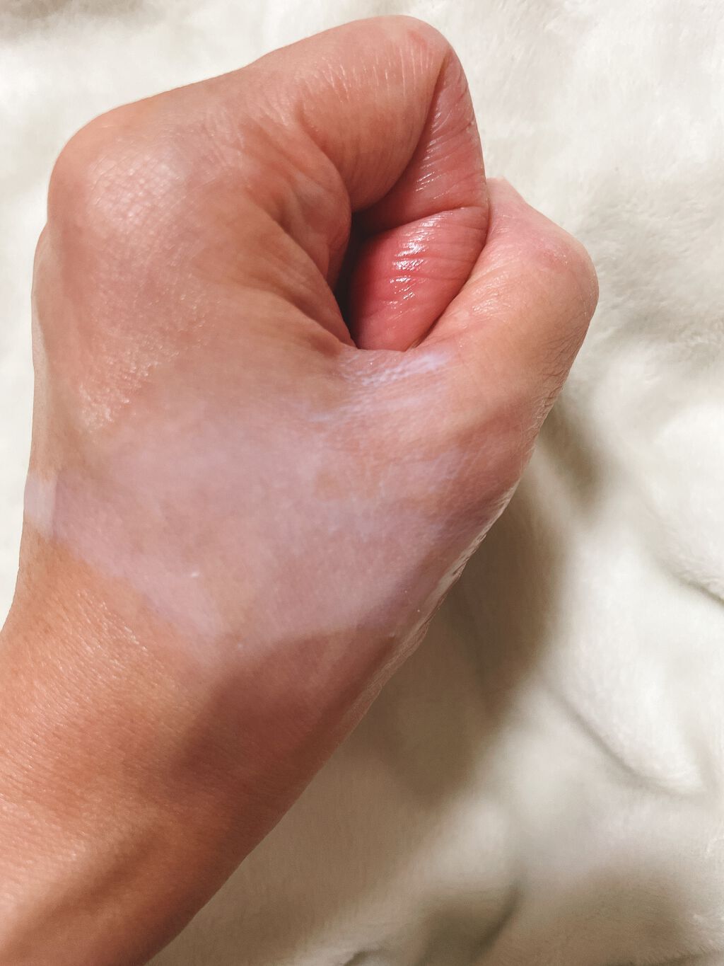 シティスプレー/エステダム/その他スキンケアを使ったクチコミ（2枚目）