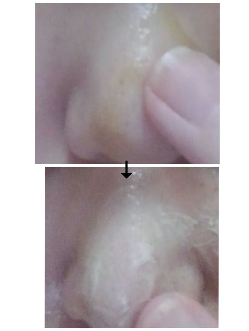 直ヌリジェル石けん/デオナチュレ/ボディソープを使ったクチコミ(4枚目)