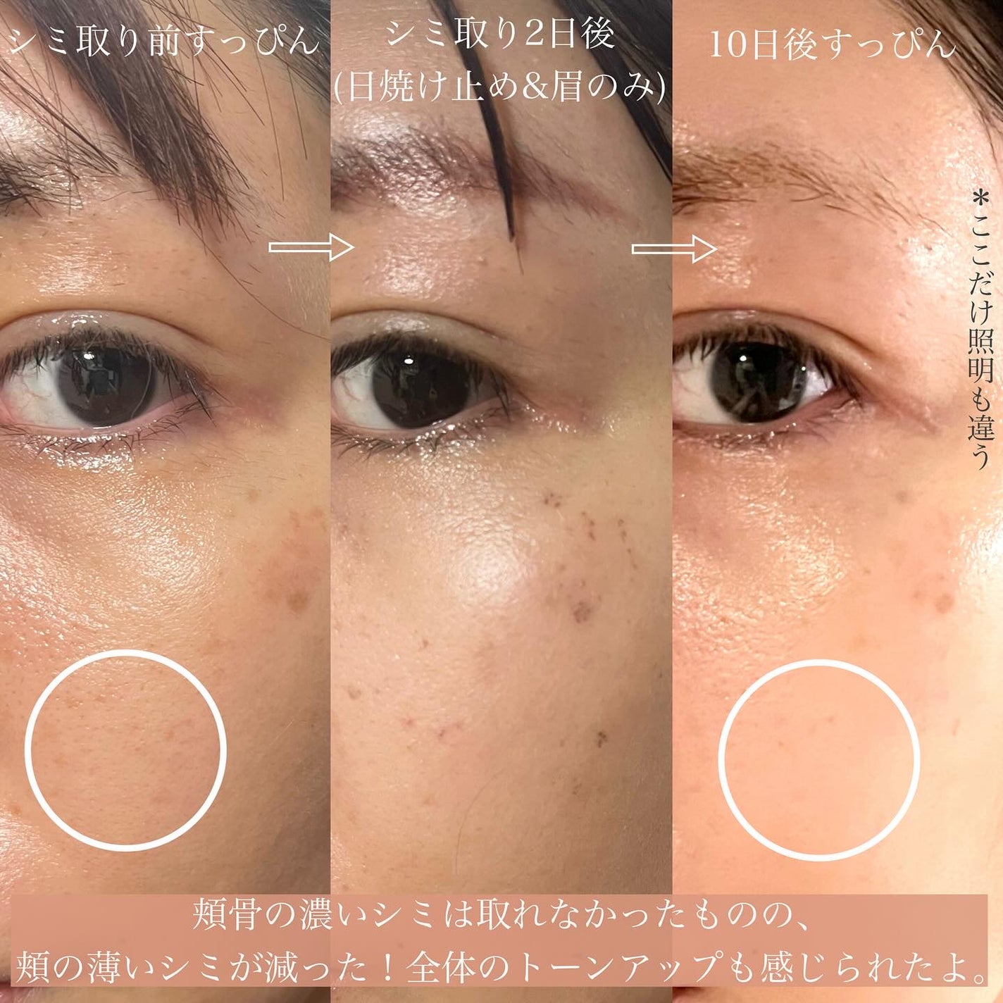 manað«§ãããã©ã§æ¥œãã倧人ã®çŸå®¹/ã³ã¹ã¡ on LIPS ãã·ãåãåäœéš//ã€ããã®åãåããŠã®ã·ãåãã¬ãŒã¶ãŒãããŠã..ãïŒ3æç®ïŒ