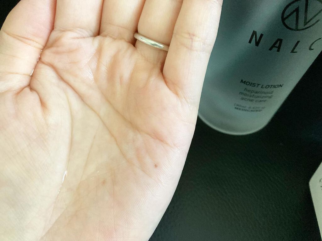 薬用モイストローション/NALC/化粧水を使ったクチコミ（2枚目）
