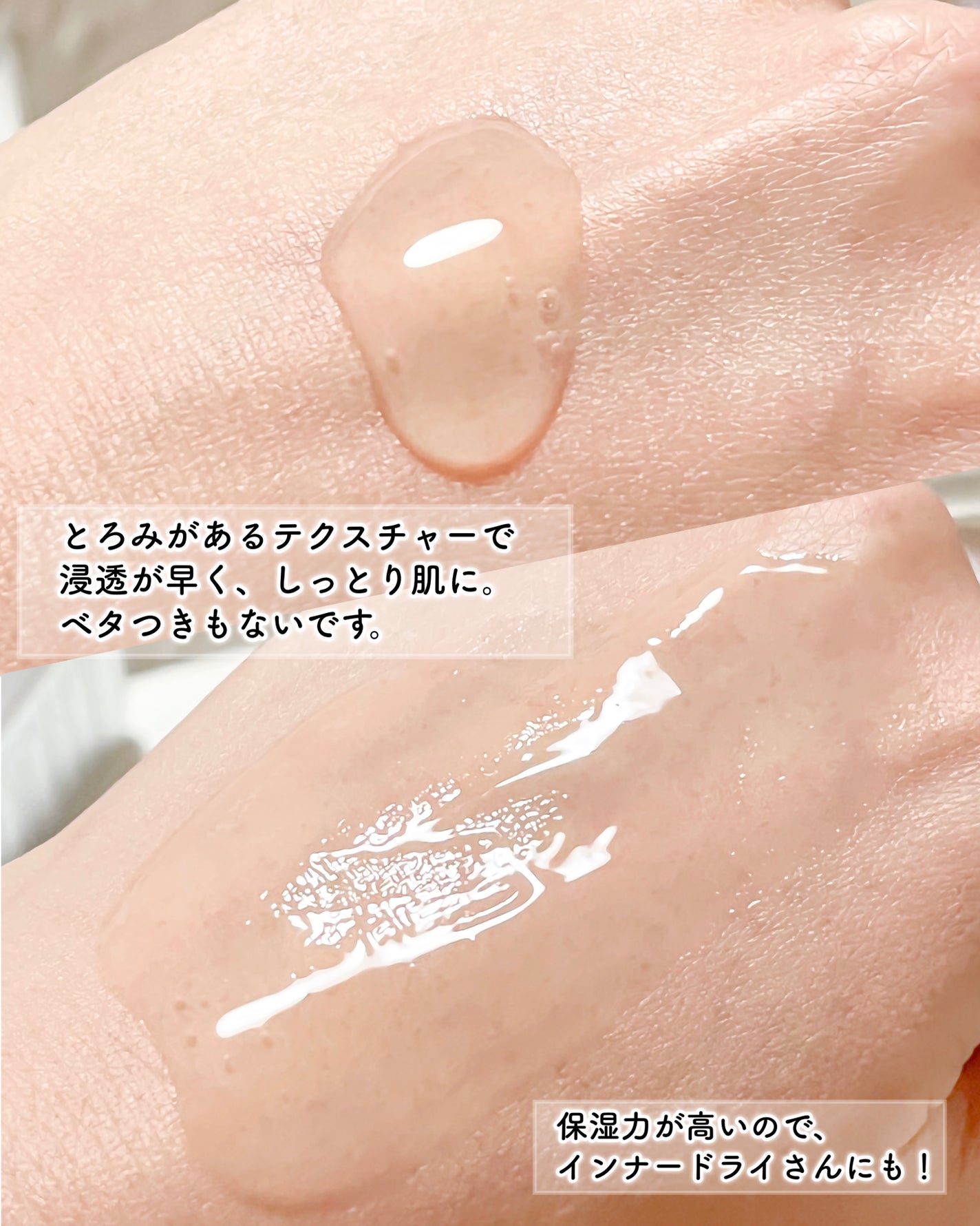 エーデルワイスリフティングセラム/Genabelle/美容液を使ったクチコミ(5枚目)