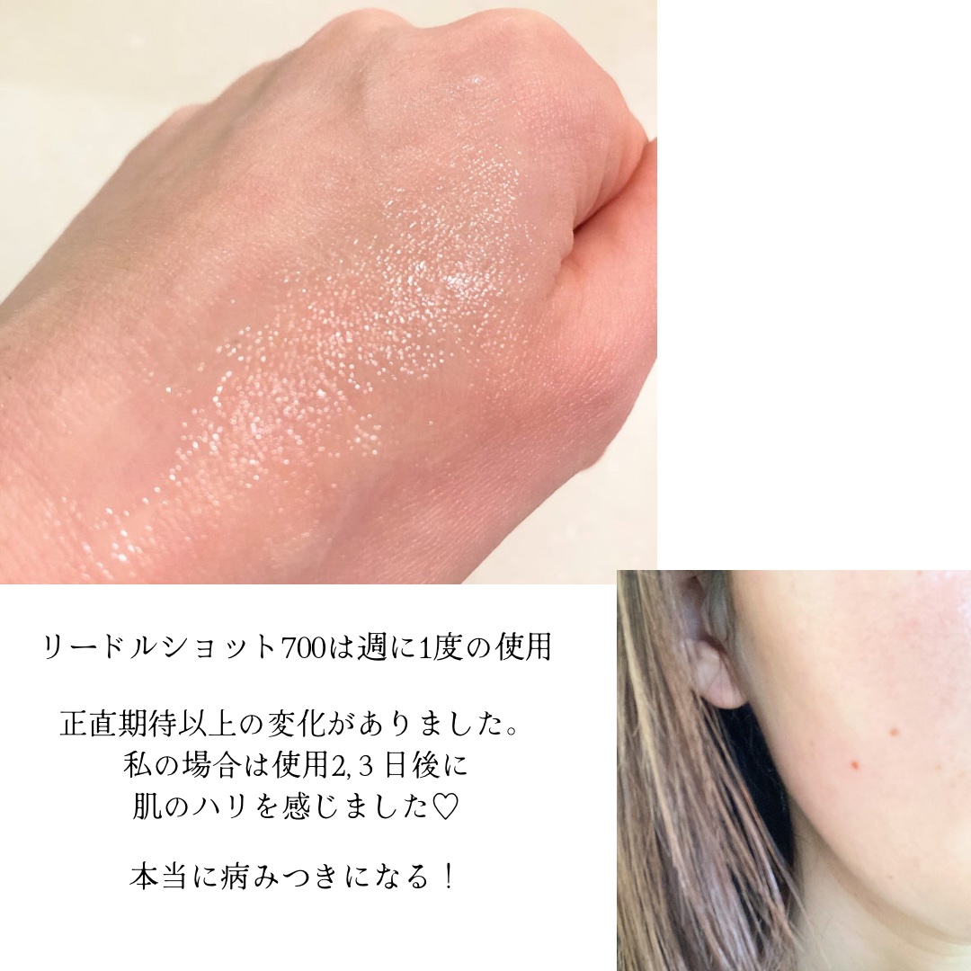 リードルショット ビタライトCエッセンス/VT/美容液を使ったクチコミ（3枚目）