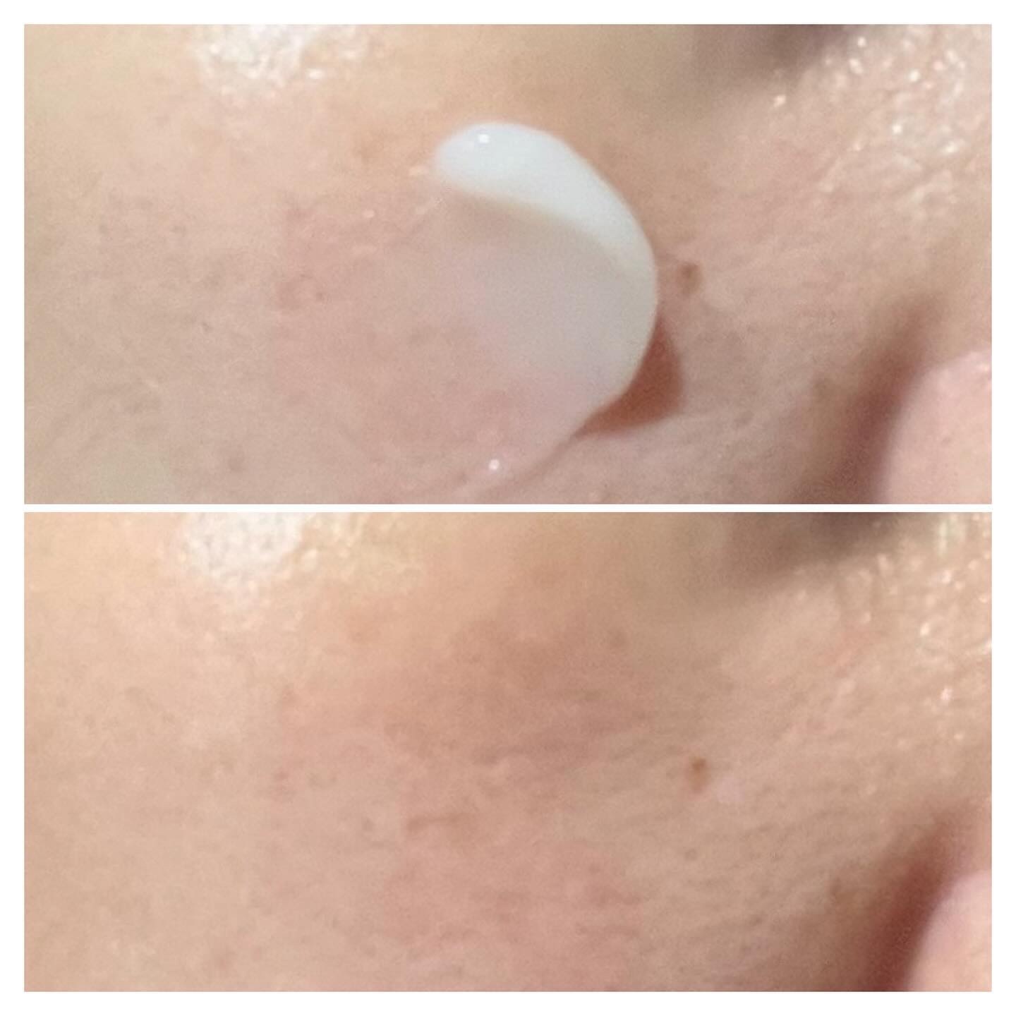 ディセンシア つつむ ローションセラム E/DECENCIA/化粧水を使ったクチコミ（3枚目）