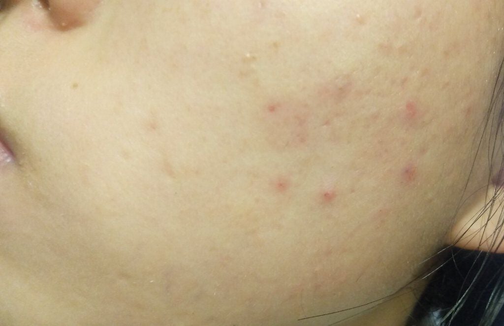 りん on LIPS 「皆さん!!助けてください!どうも、りん🌼🍨です。久しぶりの投稿..」(3枚目)