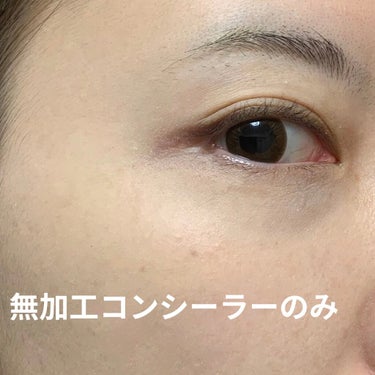 SKINFETISH: SUBLIME PERFECTION CONCEALER/PAT McGRATH LABS/コンシーラーを使ったクチコミ（3枚目）