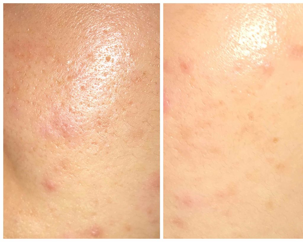 ウォッシャブル コールド クリーム/ちふれ/クレンジングクリームを使ったクチコミ（2枚目）