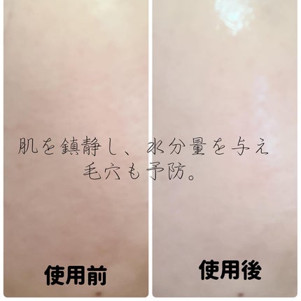 ヘルプミー! アイスクーリングパッド/One-day's you/トナーパッドを使ったクチコミ(3枚目)