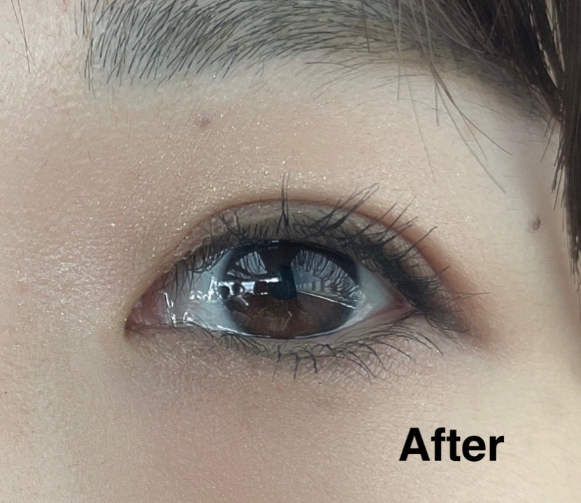 メッシュ アイテープ/shefun/二重まぶた用アイテムを使ったクチコミ（1枚目）