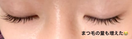 EGUTAM エグータム/アルマダスタイル/まつげ美容液を使ったクチコミ(4枚目)
