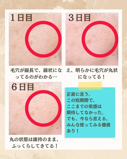 シカレチA エッセンス0.1/VT/美容液を使ったクチコミ(4枚目)