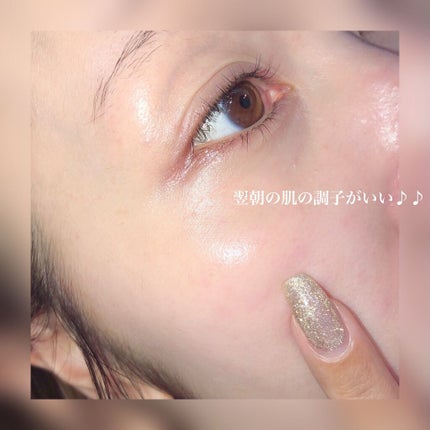 メディリフト 3Dマイクロフィラー(口元用)/YA-MAN TOKYO JAPAN/シートマスク・パックを使ったクチコミ(7枚目)