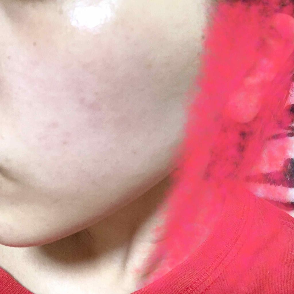 ハトムギ化粧水(ナチュリエ スキンコンディショナー R )/ナチュリエ/化粧水を使ったクチコミ（3枚目）